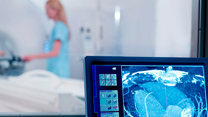 Leveraging AI in PSMA PET/CT for Prostate Cancer Detection image